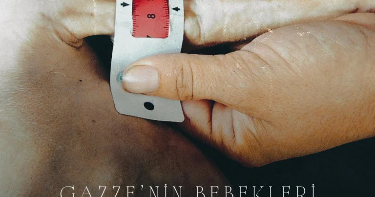 Gazze nin bebekleri açlıktan ölüyor