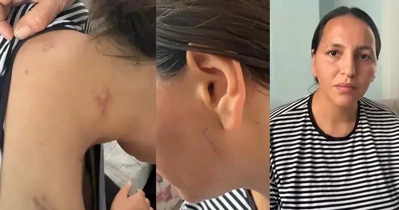 17 bıçak darbesiyle yaralanan Havva, tutuklanan eşinin en ağır cezayı almasını istedi