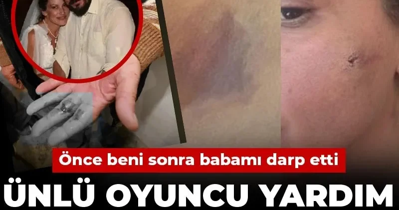 Ünlü oyuncu Yıldız Asyalı yardım çağrısında bulundu: Önce beni sonra babamı darp etti