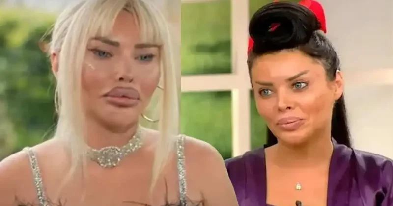 Estetik bağımlısı fenomen durmak bilmiyor! Pınar Özkurteller, bu kez de gözlerini boyattı