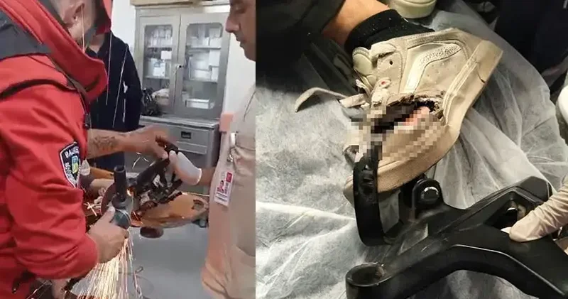 Kazada motosiklet sürücüsünün ayağına demir parçası saplandı