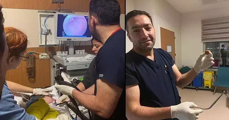 Zihinsel engelli kadının yemek borusuna kaçan ceviz, operasyonla çıkarıldı