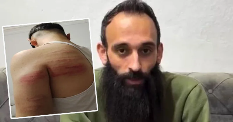 SON DAKİKA HABERİ: 2 çırağını demir sopayla dövdü! Tuvalete kilitleyip temizlik yaptırdı Son dakika haberleri