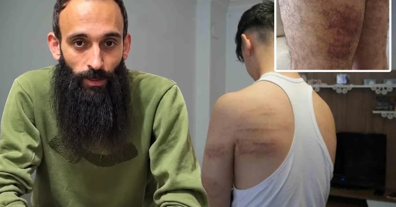 15 yaşındaki çırağa işkencede yeni gelişme! Yeniden gözaltına alınan cani berber tutuklandı