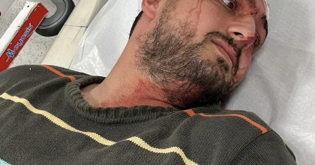 Otizmli genci odunluğa baktı diye darbeden fırın çalışanı tutuklandı Kocaeli Haberleri