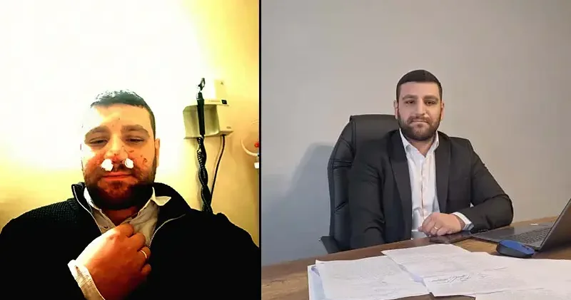 Trafikte yol verme tartışmasında avukatın burnu kırıldı