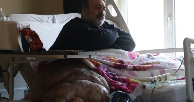 5 yıldır evden çıkamayan 300 kiloya ulaşan fil hastasının hayali; eşiyle kol kola caddede gezmek Kayseri Haberleri