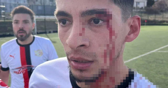 Maç sonrası saha içi savaş alanına döndü, 3 futbolcu hastanelik oldu Gülümbespor Başkanı Ergün Akbal: Yaşanan bu olayla ilgili tüm adli şikayetler yapılmış olup, takipçisi olunmaya devam edilecektir Bilecik Haberleri