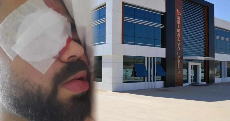 200 lira koruyucu gözlük verilmeyen işçi yüzde 80 kör kaldı!