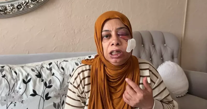 Rögar Kazası: Elektrikli Bisikletli Kadın Yaralandı