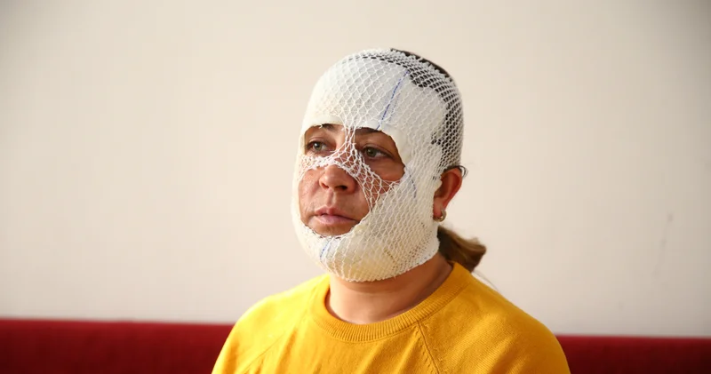 Prenses bakım 2. derece yanığa neden oldu Son dakika haberleri