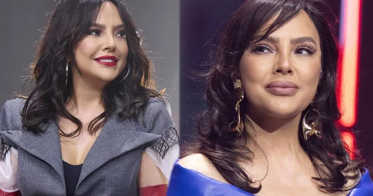 Ebru Gündeş: yüz gerdirmeyle 10 yaş gençleştim