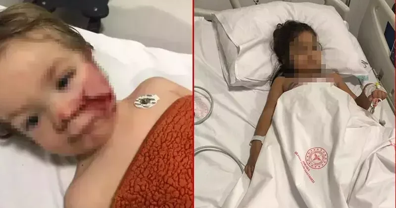 Ankara da 2 kardeşi yaralayan pitbullun sahibinin annesi hakkında suç duyurusu kararı