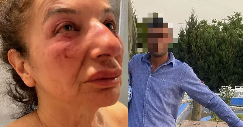 Yardım bahanesiyle eczacı kadını çağırdı! Kemerle boğmaya çalıştı
