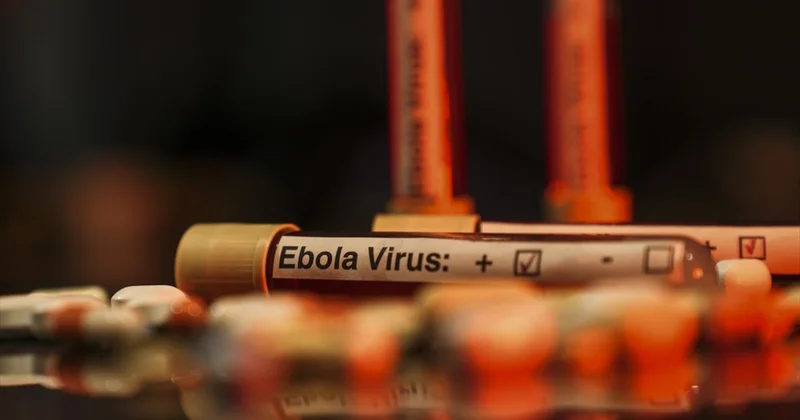 DSÖ: KDC deki Ebola salgınında genel risk çok yüksek