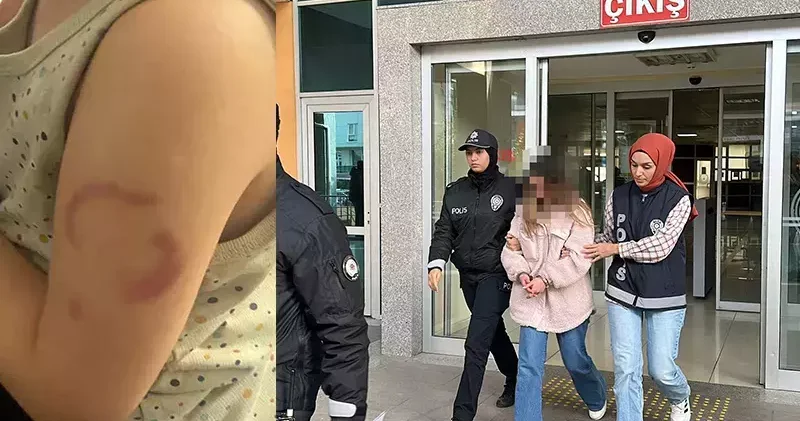 Bakımevinde 3 yaşındaki öğrencisinin kolunu ısıran öğretmen tutuklandı