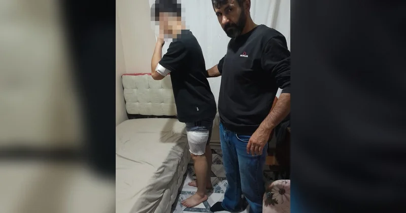 Akran zorbalığı: Okuldaki mendil kapma yarışında başlayan kavgada 16 yaşındaki çocuk, bıçaklandı!