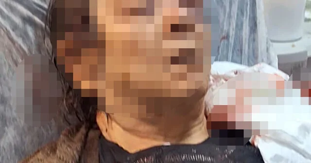 Evde otururken tavandan kopan moloz yığını altında kalan kadın yaralandı Kayseri Haberleri Habertürk Yerel Haberler