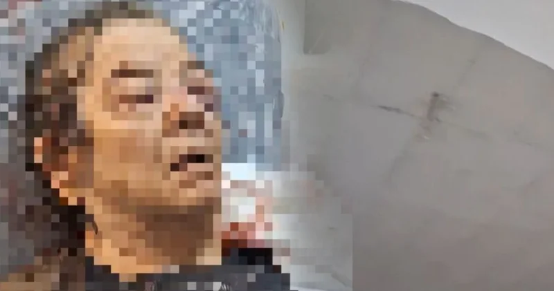SON DAKİKA HABERLERİ: Evde otururken tavandan koptu! Görme kaybı yaşadı, burnu kırıldı Son dakika Kayseri haberleri Son dakika haberleri