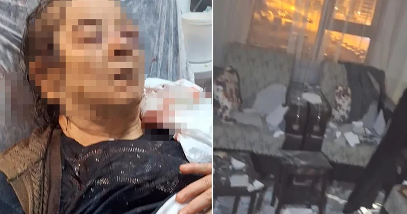 Kayseri de tavandan kopan moloz altında kalan 75 yaşındaki F.Ö. görme kaybı yaşadı