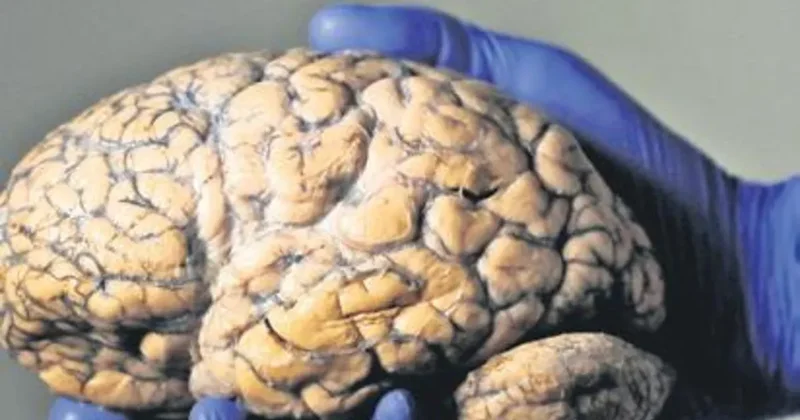 Beyni korumanın 6 yolu