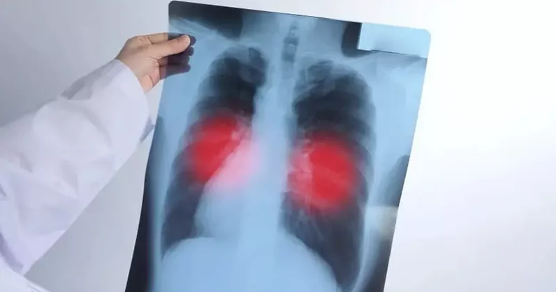 Akciğerinize kalıcı zarar veriyor! Siz de sık sık yaşıyorsanız dikkat