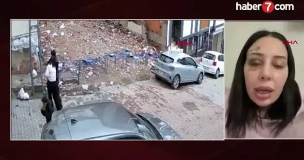 Ameliyat parasını karşıladıktan sonra eşine saldırdı! İşte skandal olayın perde arkası