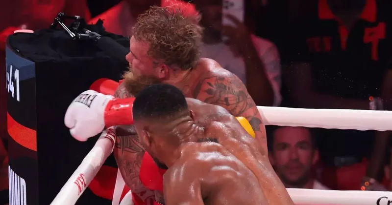 Fenomen boksörün çenesi iki yerden kırılmış: Titanyum plak takıldı