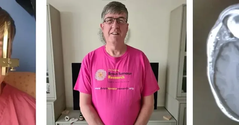 Kulak çınlamasını hafife aldı, gerçek MR’da ortaya çıktı: Ameliyat edilemeyen beyin tümörüyle karşı karşıya kaldı Sözcü Gazetesi