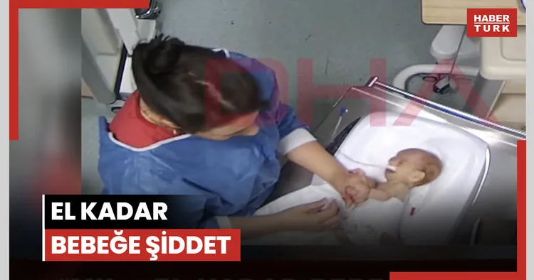 5 günlükken darp edildi, engelli kaldı!