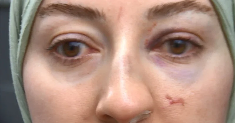 Çığlığı duyan koştu... Video kaydediyor diye kadını bu hale getirdiler Sözcü Gazetesi