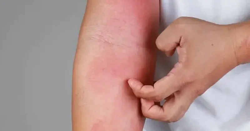 İstanbul da büyük tehlike! Kuduz vakaları artıyor! En çok görülen ilçeler belli oldu