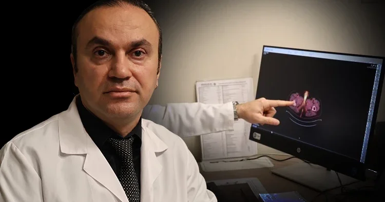 Uzman isimden fazla tüketmeyin uyarısı: 38 yaşındaki hastanın penisi alındı Dünyada 60 vaka var, sonuncusu Türkiye de görüldü