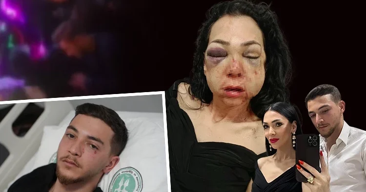 Kadınlar var diye uyarılınca dehşet saçtılar! Anne ve oğluna feci dayak... Çocuğumun gözü önünde bana bunu yaptılar