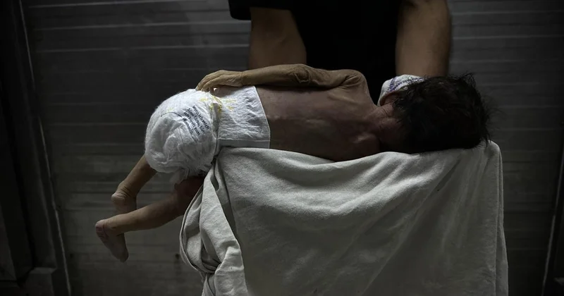 Gazze de savaşın gölgesinde bebek ölümleri ve doğum kusurları artıyor