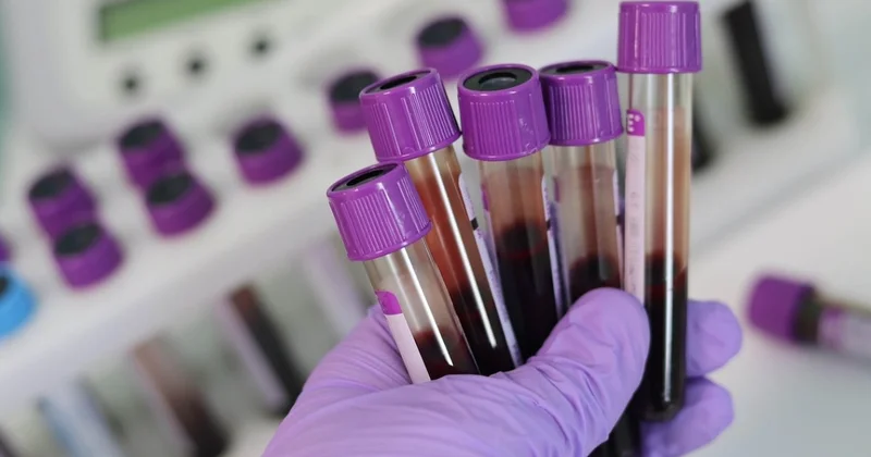 Bağışıklık sistemi en güçlü kan grubu belli oldu Sözcü Gazetesi