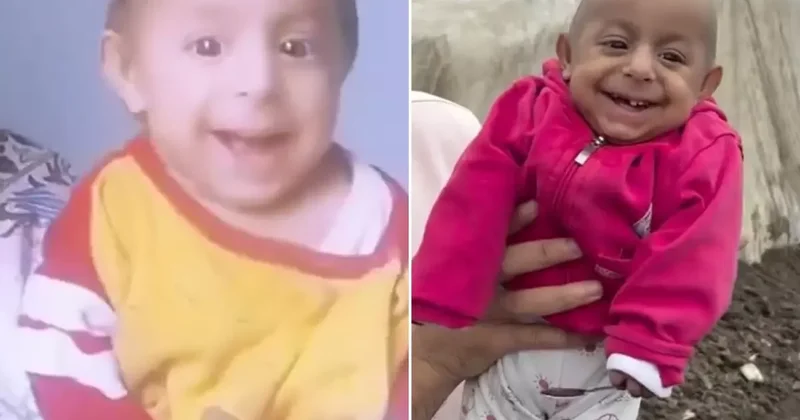 Gülen Bebek olarak tanınan Ökkeş Bebek hayatını kaybetti