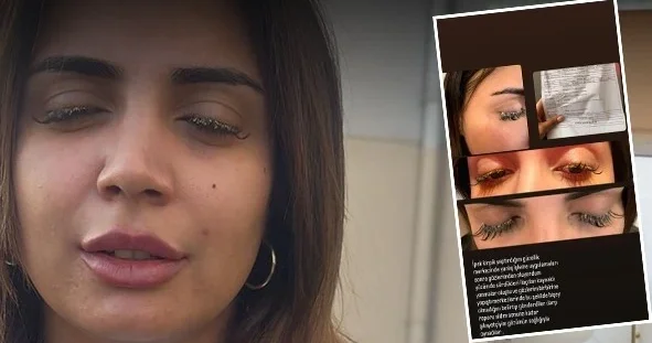 Güzellik merkezinde gözüne yapıştırıcı kaçan genç kadın az kalsın kör olacaktı