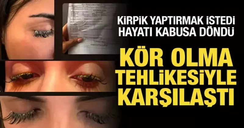 Kirpik yaptırmak isteyen kadının hayatı kabusa döndü: Kör olacaktı!