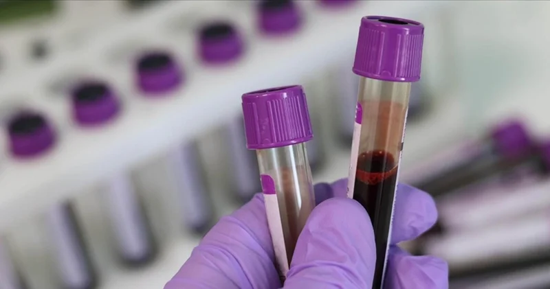 Kan kanserinde immünoterapilerle tedavide yeni dönem Sağlık Haberleri