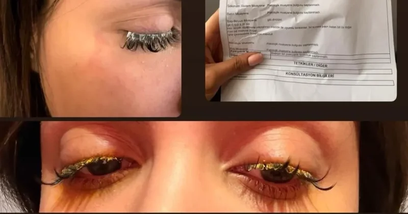 Esenyurt ta güzellik merkezinde akılalmaz iddia: Gözüm acıyor dedi tehdit edildi! Kör olabilirdim