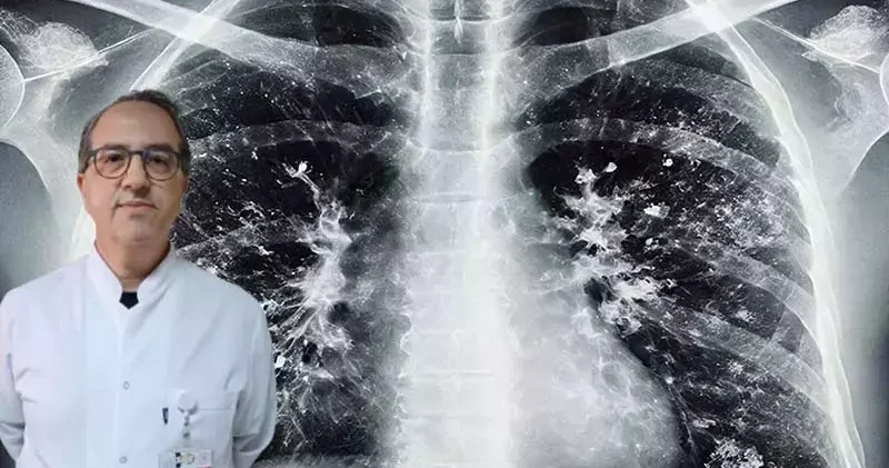 Prof. Dr. Şener den süperenfeksiyon uyarısı: Dikkat etmek lazım, ücretsiz aşınızı olun