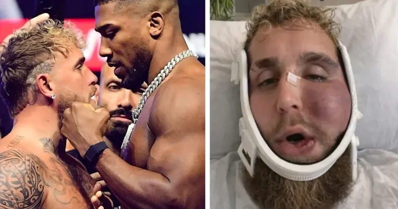 Suratı tanınmaz hale gelen Jake Paul un ne kadar kazandığını duyunca şok olacaksınız