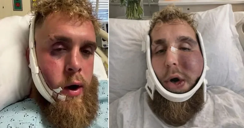 Saniyede 4 milyon TL kazandı suratı bu hale geldi Sözcü Gazetesi