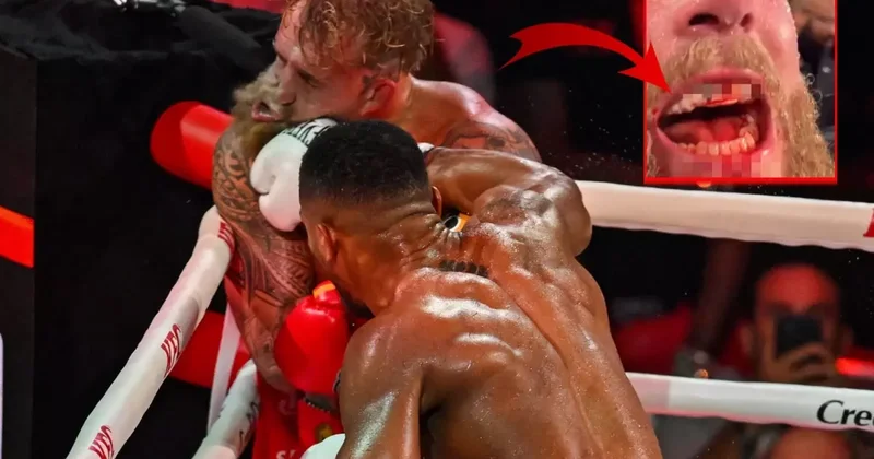 6. rauntta kabusu yaşamıştı! İşte çenesi kırılan Jake Paul un son hali