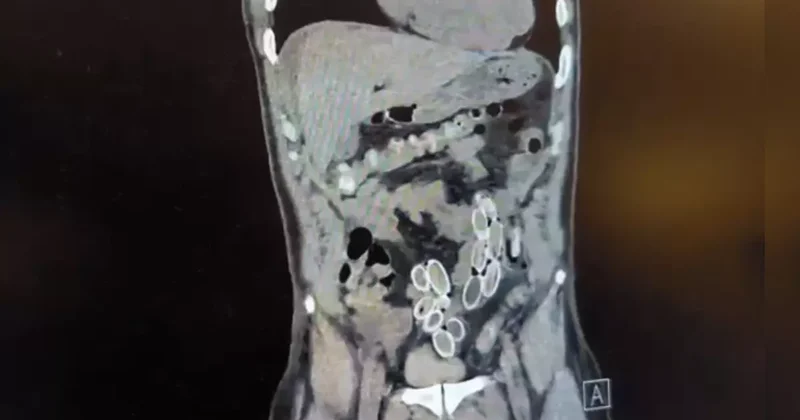 Fas tan Türkiye ye Uyuşturucu Taşırken Yakalandı