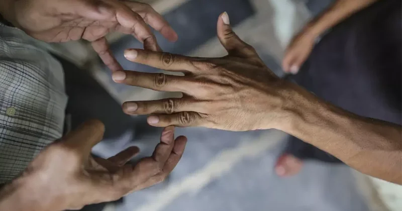 44 yıl sonra bir ilk! 2 ülkede cüzzam vakaları görülmeye başladı