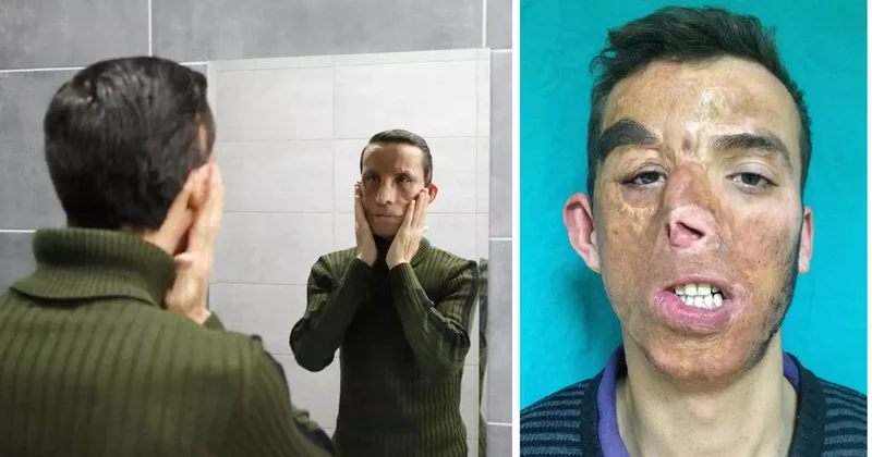 14 yıldır aynaya başka bir yüzle bakıyor! Yaşı bile o gün değişti