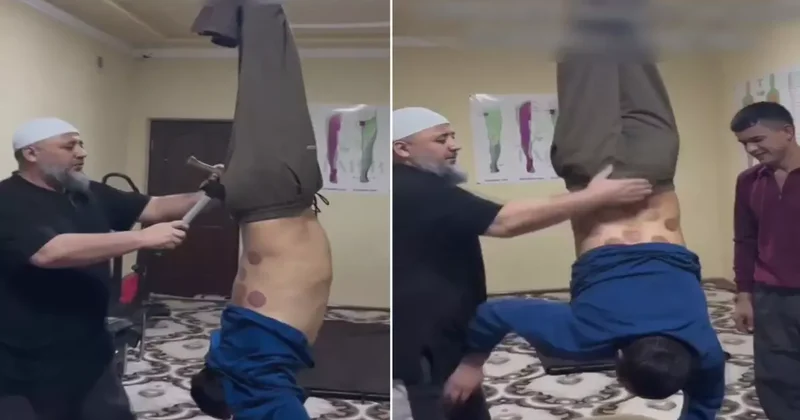 Tedavi değil işkence! Ayaklarından tavana asıp çekiç ve kazıkla...