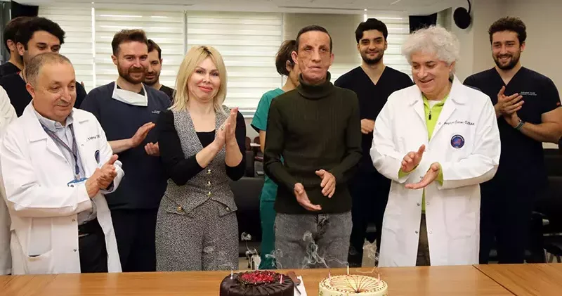 İlk yüz nakilli Uğur Acar, hayata 14 yıldır başka bir yüzle bakıyor